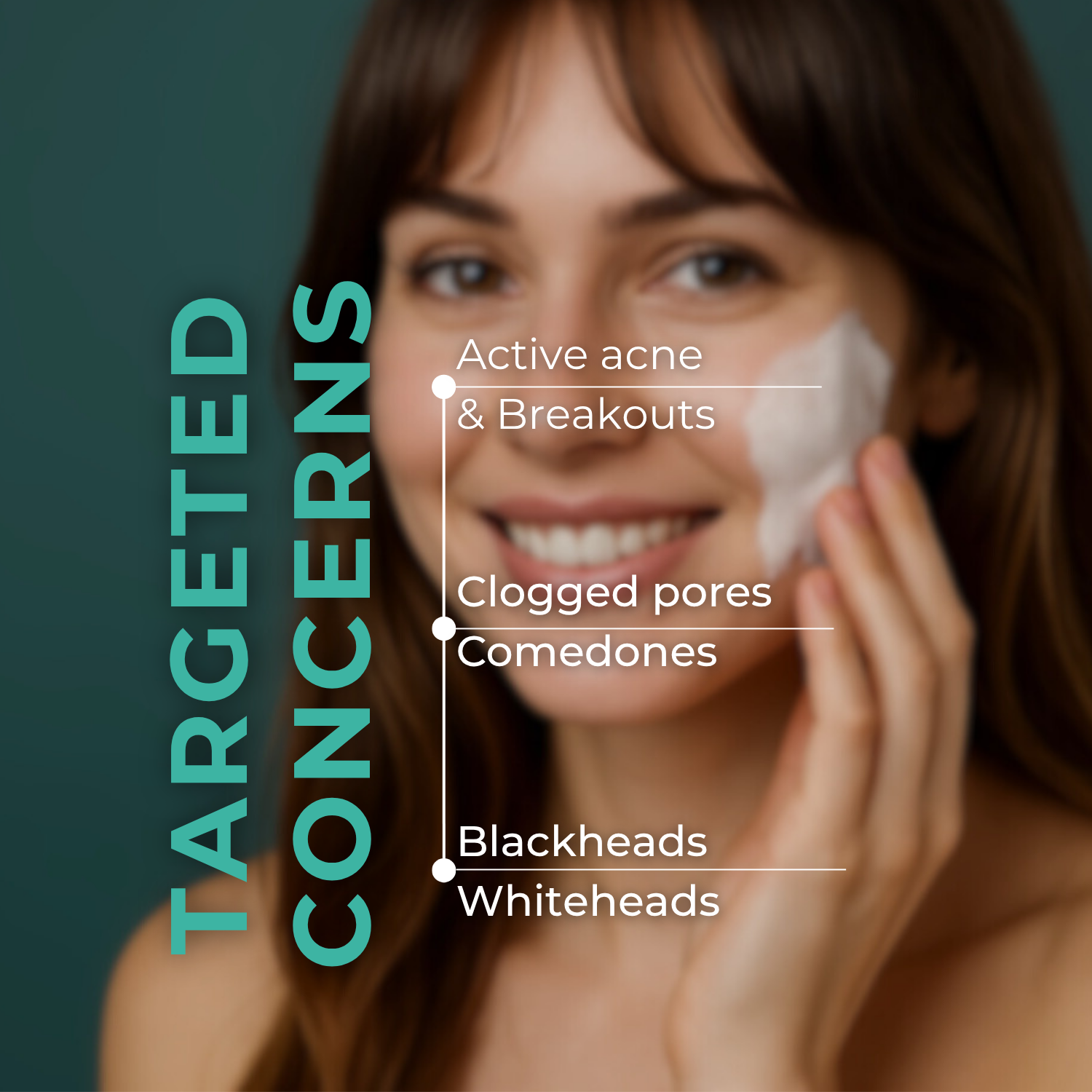 ANTI ACNE Facewash (1% Glycolic Acid + Salicylic Acid)