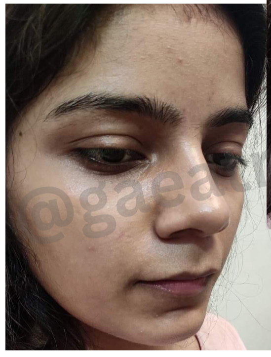 PIGMENTATION Trial Kit