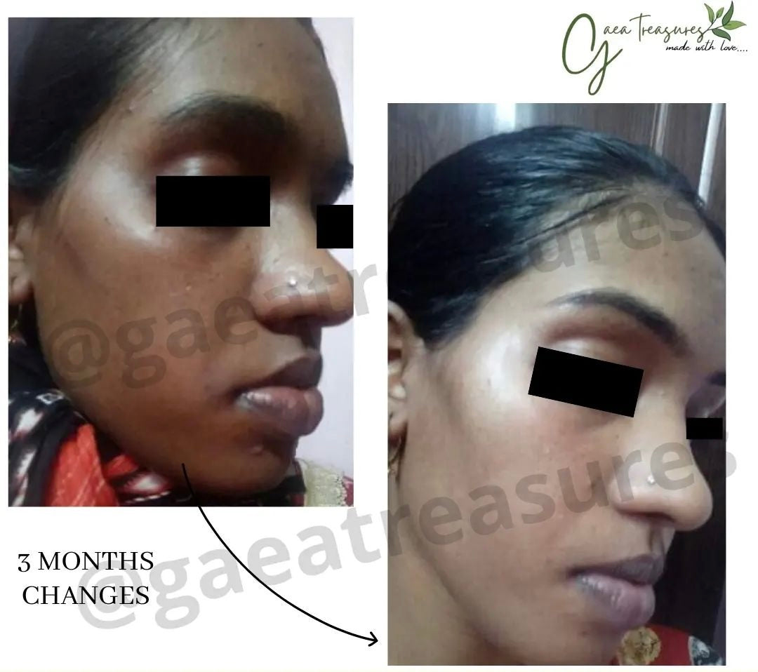 PIGMENTATION Trial Kit